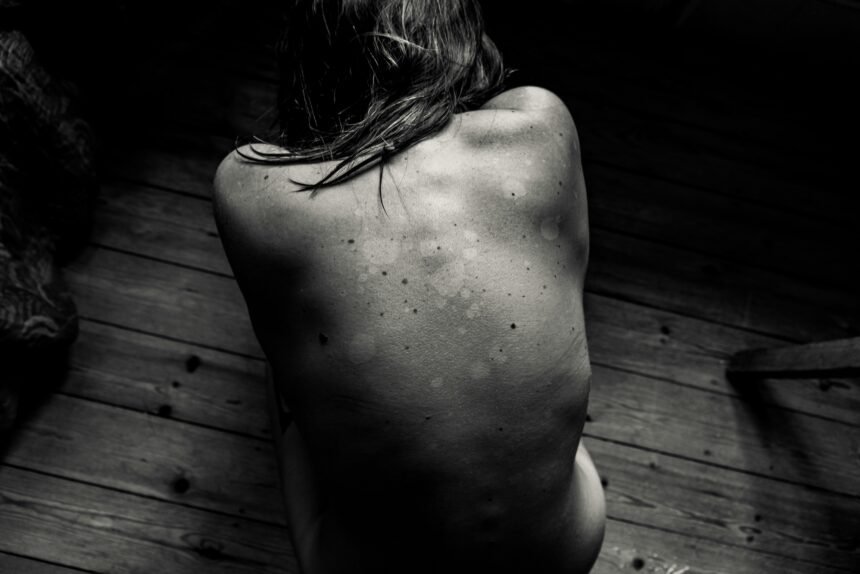 Healing Past Trauma: Embracing Recovery One Step at a Time